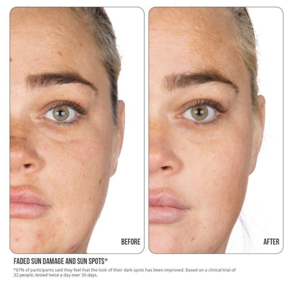 NIP+FAB Facial Bundle: Vitamin C Tonic & Retinol Fix Blemish Treatment - Picture 3 of 8
